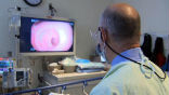 The Mayo Clinic has a new test for colon cancer that is less invasive or arduous than previous screening tests. Image of The Mayo Clinic has a new test for colon cancer that is less invasive or arduous than previous screening tests.