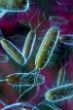 Drug resistant infections, like E. coli, are expected to resist more antibiotics, making infection prevention impossible. Image of Drug resistant infections, like E. coli, are expected to resist more antibiotics, making infection prevention impossible.