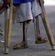 Doctors have no idea what is really causing paralysis in more than 100 kids throughout the United States. Image of Doctors have no idea what is really causing paralysis in more than 100 kids throughout the United States.