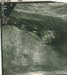 Image of