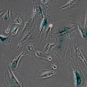 Researchers suggest that the deterioration of these genetic bundles may play a role in the aging process. Researchers suggest that the deterioration of these genetic bundles may play a role in the aging process.