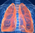 Legionnaires' disease is a lung bacteria that causes flue-like muscle pain, headaches, fevers, drowsiness, chills and in some cases delirium. Image of Legionnaires' disease is a lung bacteria that causes flue-like muscle pain, headaches, fevers, drowsiness, chills and in some cases delirium.