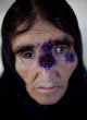 Leishmaniasis, the Image of Leishmaniasis, the