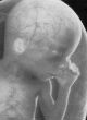 New study indicates false positives for fetal abnormalities. Image of New study indicates false positives for fetal abnormalities.