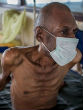 WHO considers new TB treatment (Philippe Schneider/World Vision). Image of WHO considers new TB treatment (Philippe Schneider/World Vision).