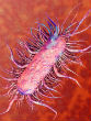 A woman has been diagnosed with a frightening E. coli superbug in Pennsylvania (Inhabitat). Image of A woman has been diagnosed with a frightening E. coli superbug in Pennsylvania (Inhabitat).