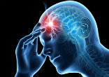 How can you prevent a stroke? Image of How can you prevent a stroke?
