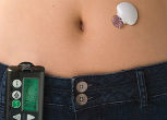 An artificial pancreas can help women suffering diabetes. Image of An artificial pancreas can help women suffering diabetes.