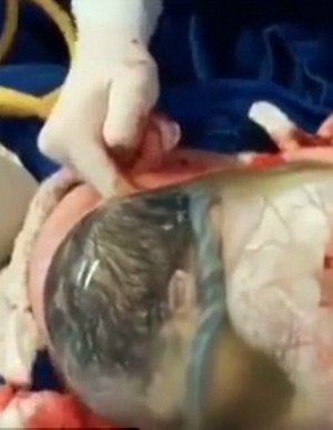 Extraordinary rare birth caught on camera showing live baby born inside the amniotic sac - Marriage & Family - Home & Family - News - Vimarsana News