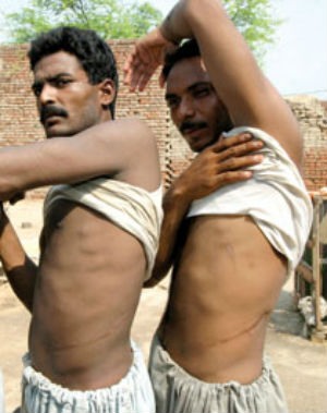 Illegal migrants are coerced to sell their organs in exchange for money or sex. Illegal migrants are coerced to sell their organs in exchange for money or sex.