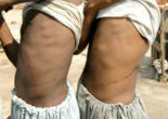 Illegal migrants are coerced to sell their organs in exchange for money or sex. Image of Illegal migrants are coerced to sell their organs in exchange for money or sex.