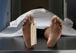 Thousands die each year as antibiotic-resistant infections strike hard. Image of Thousands die each year as antibiotic-resistant infections strike hard.