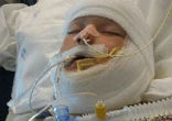 A 10-year-old boy special needs boy was set on fire by another child (Team Kayden/GoFundMe). Image of A 10-year-old boy special needs boy was set on fire by another child (Team Kayden/GoFundMe).