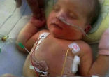 Little Frankie received a miracle (Alex Cousins/SWNS). Image of Little Frankie received a miracle (Alex Cousins/SWNS).