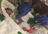 Baby born at 25-weeks weighed only 14-ounces (PA Real Life). Image of Baby born at 25-weeks weighed only 14-ounces (PA Real Life).