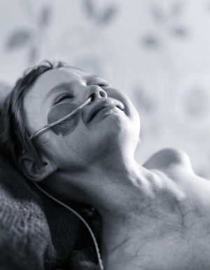4-year-old girl dies after photograph of the real face of cancer goes viral - Join us in prayer for Jessica Whelan and her family - Marriage & Family - Home & Family - News - Vimarsana News