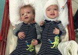 Jadon and Anias McDonald survived separation surgery (Nicole McDonald/Facebook). Image of Jadon and Anias McDonald survived separation surgery (Nicole McDonald/Facebook).