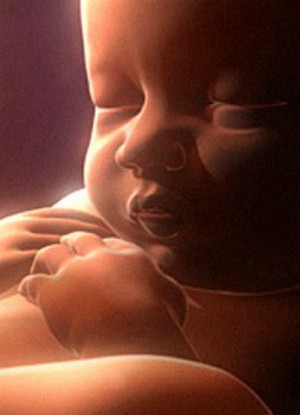 Lawmakers push to put an end to abortions. Lawmakers push to put an end to abortions.