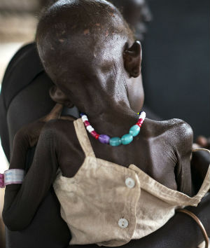 5.5 million people are starving in South Sudan. 5.5 million people are starving in South Sudan.