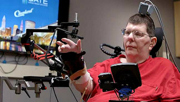 Bill Kochevar is now able to move his arm again using a brain implant that translates his thoughts into motion. Bill Kochevar is now able to move his arm again using a brain implant that translates his thoughts into motion.
