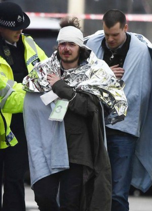 Several were injured in the attack. Several were injured in the attack.