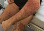 One man was attacked in the street by complete strangers (Chris Bonney/Facebook). Image of One man was attacked in the street by complete strangers (Chris Bonney/Facebook).