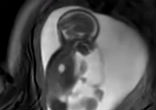 These MRI scans are taking images to the next level. Image of These MRI scans are taking images to the next level.
