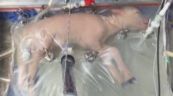A lamb can be raised in an artificial womb. Humans are next. A lamb can be raised in an artificial womb. Humans are next.