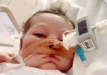 Charlie Gard was diagnosed with a very rare syndrome. Image of Charlie Gard was diagnosed with a very rare syndrome.