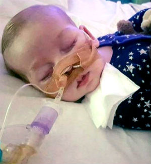 Charlie Gard was born with the Mitochondrial DNA depletion syndrome. Charlie Gard was born with the Mitochondrial DNA depletion syndrome.