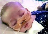 Charlie Gard was born with the Mitochondrial DNA depletion syndrome. Image of Charlie Gard was born with the Mitochondrial DNA depletion syndrome.