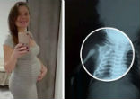 Claudineia dos Santos Melo was nine-months-pregnant when a bullet struck her baby. Image of Claudineia dos Santos Melo was nine-months-pregnant when a bullet struck her baby.
