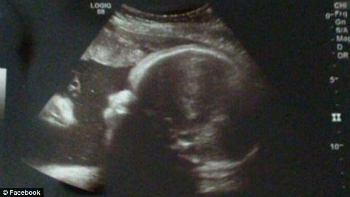 Can you spot the face of Jesus in the ultrasound? Can you spot the face of Jesus in the ultrasound?