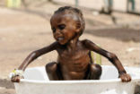 Over 20 million people in South Sudan, Somalia, Northeast Nigeria, and nearby Yemen are facing famine and starvation. Image of Over 20 million people in South Sudan, Somalia, Northeast Nigeria, and nearby Yemen are facing famine and starvation.