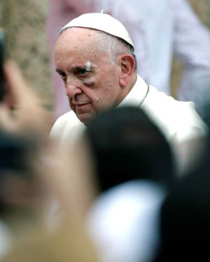 Pope Francis is reportedly 'fine' after his bloody injury in Colombia. Pope Francis is reportedly 'fine' after his bloody injury in Colombia.