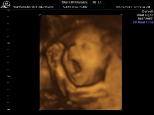 Does this look like a baby or a cluster of cells? Does this look like a baby or a cluster of cells?
