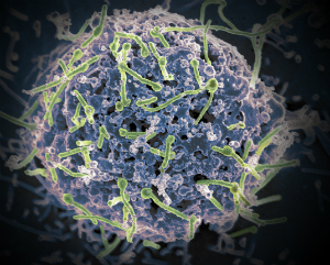 Disease X is out there, and it is just a matter of time. Disease X is out there, and it is just a matter of time.
