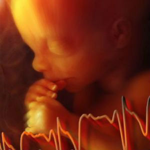 Doctors are prohibited from performing an abortion after the detection of the baby's heartbeat. Doctors are prohibited from performing an abortion after the detection of the baby's heartbeat.