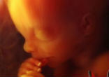 Doctors are prohibited from performing an abortion after the detection of the baby's heartbeat. Image of Doctors are prohibited from performing an abortion after the detection of the baby's heartbeat.