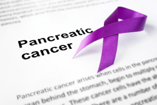 Pancreatic cancer is one of the most lethal forms of the disease. Pancreatic cancer is one of the most lethal forms of the disease.