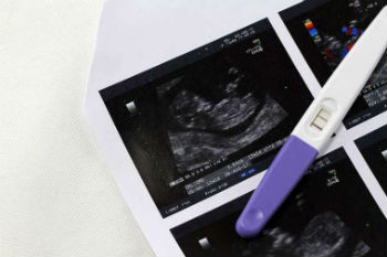 Pregnancy test Pregnancy test