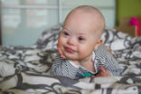 Baby with Down Syndrome Image of Baby with Down Syndrome