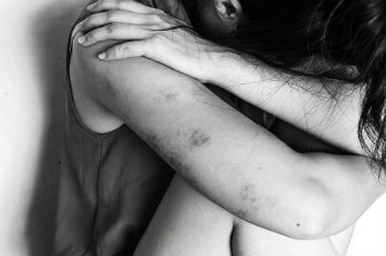 Abuse victim Abuse victim