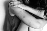Abuse victim Image of Abuse victim