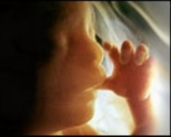 For 35 years we have prayed, marched, litigated, and tried to persuade our fellow Americans and people throughout the Western world that every procured abortion is the intentional killing of innocent human life. Our challenge persists. In addition to continuing all of these efforts, perhaps it is time to take a new tact in the verbal debate. It is time to call those who support legalized abortion the Image of For 35 years we have prayed, marched, litigated, and tried to persuade our fellow Americans and people throughout the Western world that every procured abortion is the intentional killing of innocent human life. Our challenge persists. In addition to continuing all of these efforts, perhaps it is time to take a new tact in the verbal debate. It is time to call those who support legalized abortion the