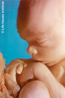 Image of