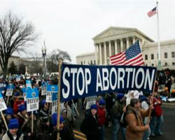 There is no “right” to kill innocent children in the womb found in the Natural Law. The TRUE RIGHT is the Right to Life. In fact this current counterfeit “abortion right” in the U.S.A. belies our claim as a Nation to being a civilized and just society. Image of There is no “right” to kill innocent children in the womb found in the Natural Law. The TRUE RIGHT is the Right to Life. In fact this current counterfeit “abortion right” in the U.S.A. belies our claim as a Nation to being a civilized and just society.