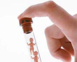 The body of a human being, from the very first stages of its existence, can never be reduced merely to a group of cells. The embryonic human body develops progressively according to a well defined program with its proper finality, as is apparent in the birth of every baby.(CDF) Image of The body of a human being, from the very first stages of its existence, can never be reduced merely to a group of cells. The embryonic human body develops progressively according to a well defined program with its proper finality, as is apparent in the birth of every baby.(CDF)
