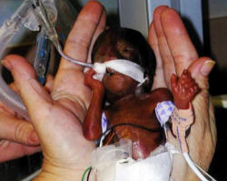 I propose to the US Congress a new framework. I invite them not only to exclude the killing of children (abortion) but to include our youngest neighbors under the plan! Image of I propose to the US Congress a new framework. I invite them not only to exclude the killing of children (abortion) but to include our youngest neighbors under the plan!
