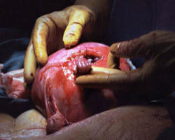 Pray that this bill will be used to open the eyes of many in our country who will not yet acknowledge the truth written on every human heart -- the child in the womb is one of us. Image of Pray that this bill will be used to open the eyes of many in our country who will not yet acknowledge the truth written on every human heart -- the child in the womb is one of us.